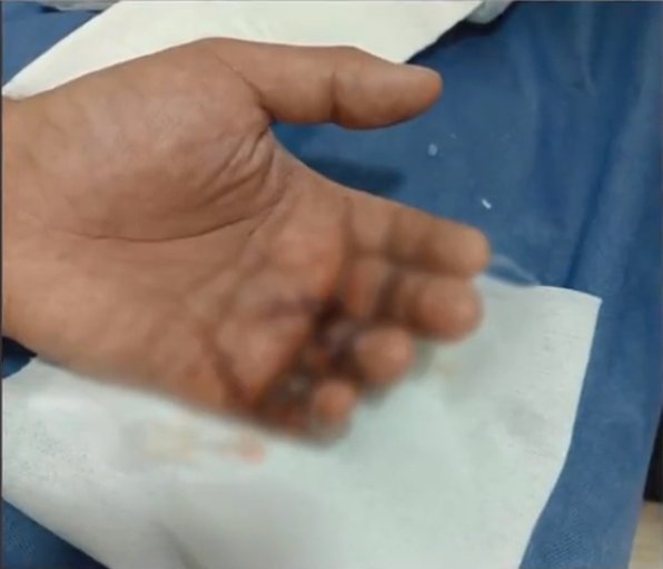 Hombre resultó herido por un atraco en Fontibón 1 Hombre resultó herido por un atraco en Fontibón La delincuencia en Bogotá no da tregua, pues recientemente se conoció el caso de un hombre de 33 años, que fue herido con cuchillo por tres bandidos que lo atracaron cuando salía de su trabajo en Fontibón.