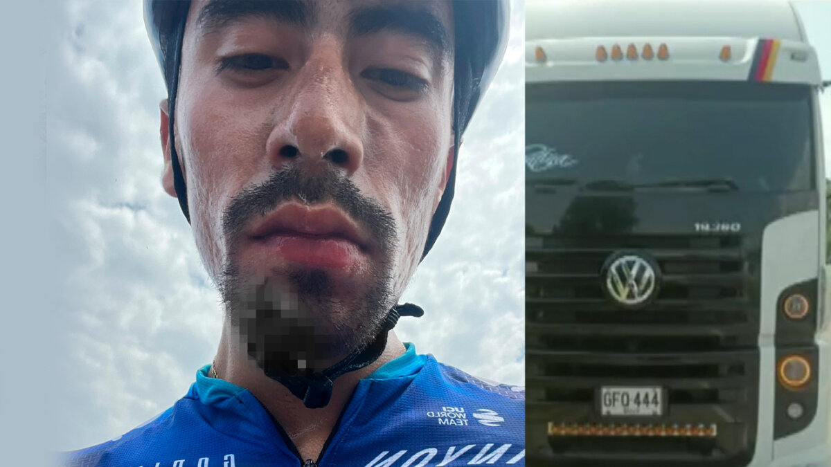 Así quedó el ciclista Iván Sosa luego de agresión que sufrió cuando entrenaba