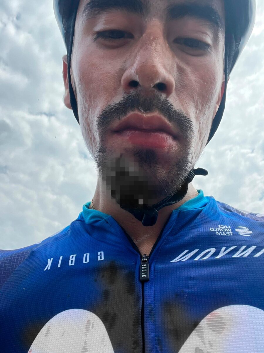 Así quedó el ciclista Iván Sosa luego de la agresión que sufrió cuando entrenaba 1 Así quedó el ciclista Iván Sosa luego de agresión que sufrió cuando entrenaba