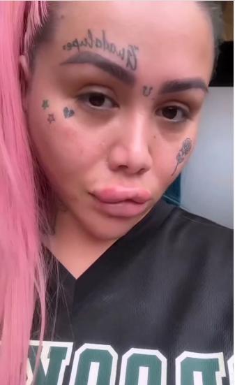 'Epa Colombia' se sometió a procedimiento estético y la comparan con Yina Calderón Daneidy Barrera Rojas, más conocida como 'Epa Colombia', viajó hasta la ciudad de Medellín el pasado fin de semana con el fin de someterse una serie de procedimientos estéticos, y en las últimas horas compartió con sus seguidores de Instagram cómo luce su aspecto físico.