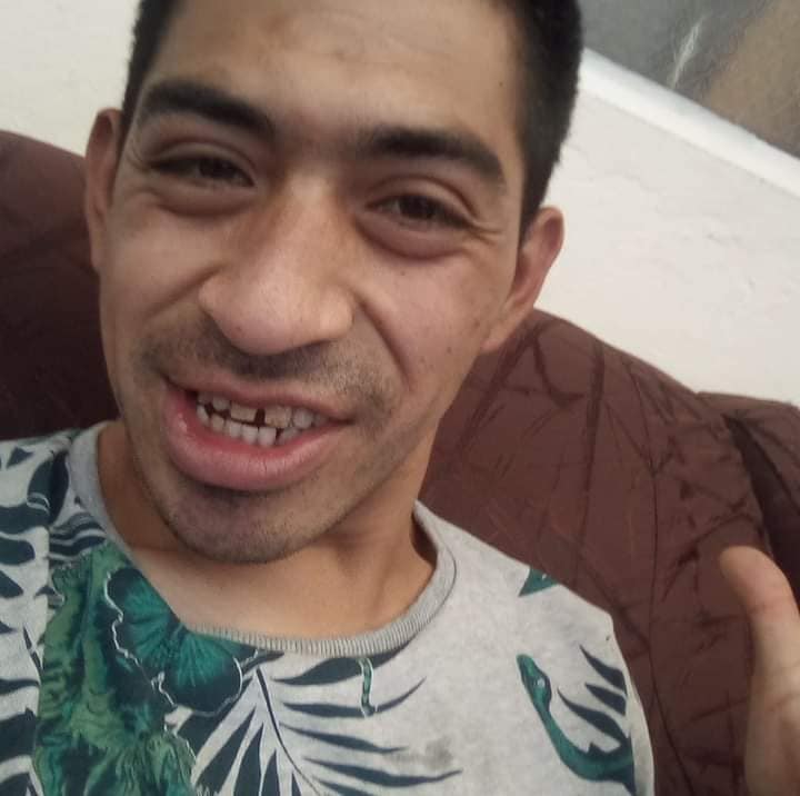 Indignación por atroz crimen de discapacitado en Bosa 2 Indignación por atroz crimen de discapacitado en Bosa La familia de la víctima y la comunidad de la localidad de Bosa esperan que el agresor, quien fue capturado, responda por el ataque al joven, quien tenía una discapacidad psicomotriz.