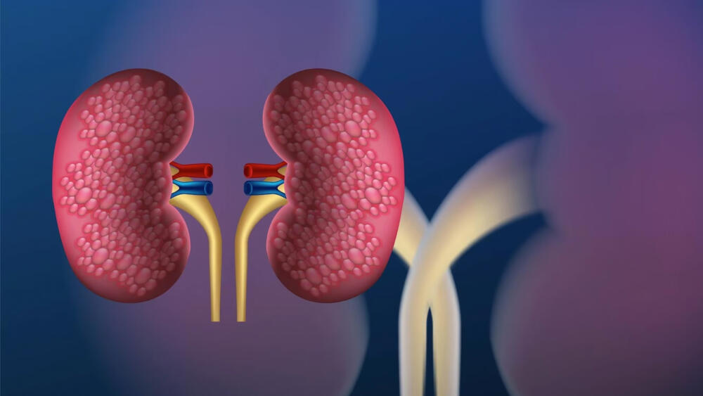 ¿Problemas con los riñones? Los riñones son el gran filtro que ayuda a desechar todas las toxinas que produce el cuerpo a través de la orina.