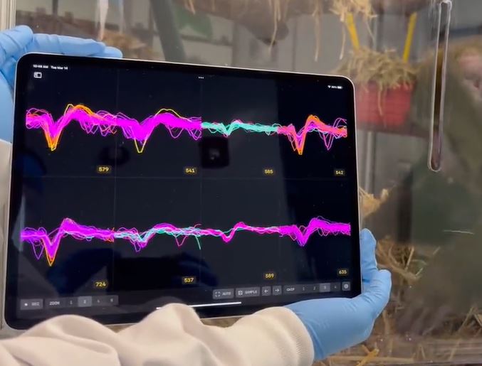 Autorizaron a empresa de Elon Musk para que implante chips cerebrales en humanos