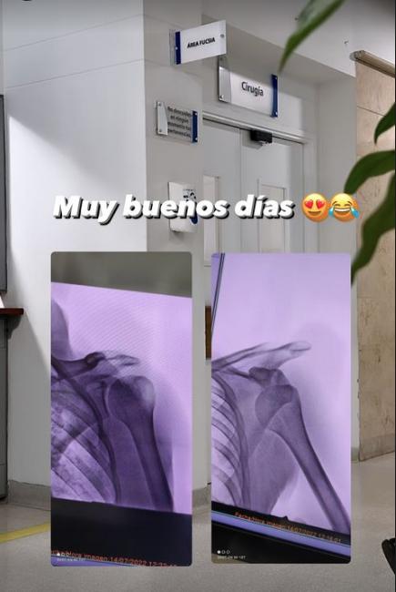 El preocupante estado de salud de Andy Rivera Andy Rivera tuvo que ingresar al quirófano por una grave lesión en su hombro.