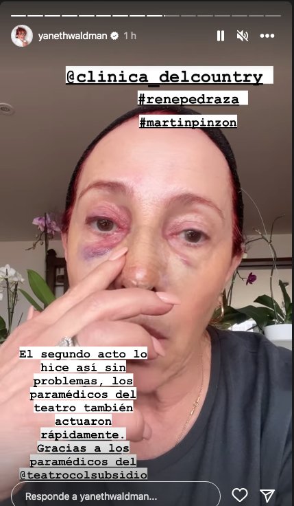 Las graves fracturas que sufrió Yaneth Waldman en su rostro 1 Las graves fracturas que sufrió Yaneth Waldman en su rostro Le contamos por qué la actriz y presentadora Yaneth Waldman terminó en el quirófano.
