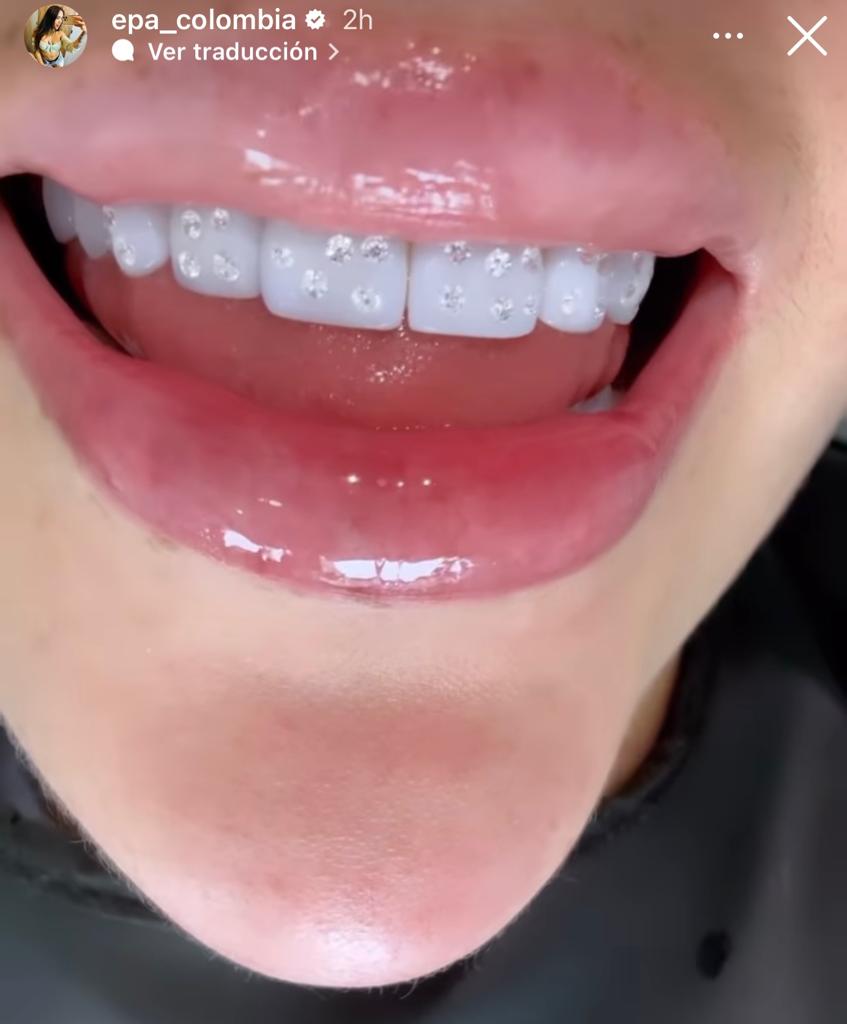 ¡De no creer! 'Epa Colombia' apareció con 80 diamantes en sus dientes 2 ¡De no creer! 'Epa Colombia' apareció con 80 diamantes en sus dientes 'Epa Colombia' sorprendió con gran cantidad de diamantes en sus dientes.