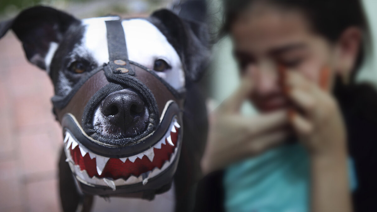 Pitbull mordió a una niña de 4 años en la cara 8 Pitbull mordió a una niña de 4 años en la cara Una pequeña de 4 años fue atacada por un perro de raza pitbull en el barrio Las Brisas, en la localidad de Kennedy.