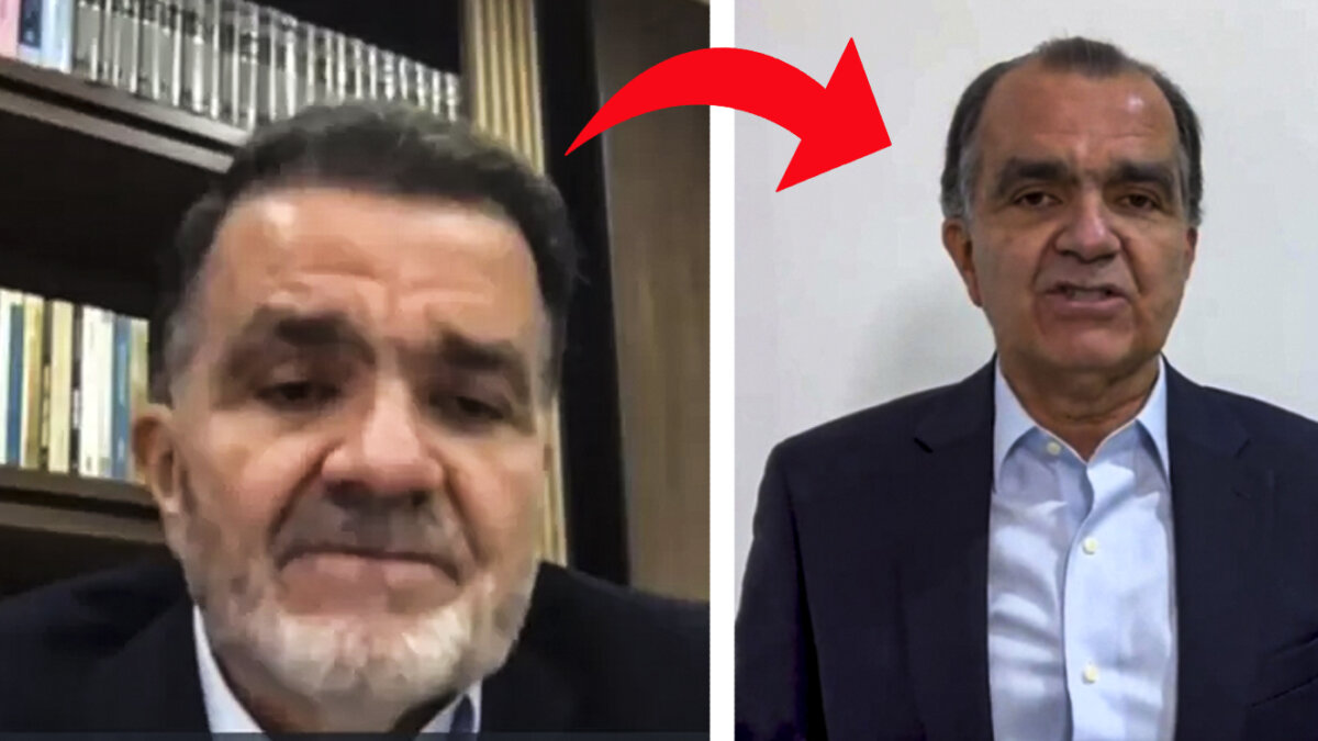 Este es el billete que vale el implante de pelo que Óscar Iván Zuluaga se habría realizado El excandidato presidencial Óscar Iván Zuluaga sorprendió con su cambio de imagen. Pille cuánto cuesta el procedimiento al que se habría sometido.