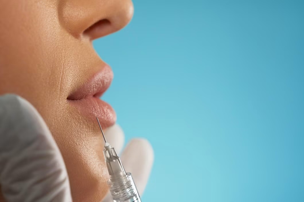 Lo que debe saber antes de pensar en aplicarse Bótox 2 Lo que debe saber antes de pensar en aplicarse Bótox Esto es lo que debe saber del bótox.