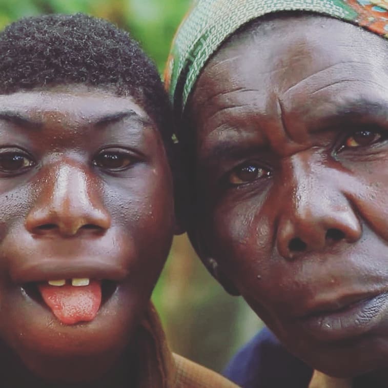 ‘El Niño de la Selva’ que conmueve al mundo 1 ‘El Niño de la Selva’ que conmueve al mundo Por su aspecto físico, Zanziman Ellie, un joven de Ruanda (África), ha tenido que soportar toda clase de comentarios malintencionados, al punto de ser llamado despectivamente ‘mono’.