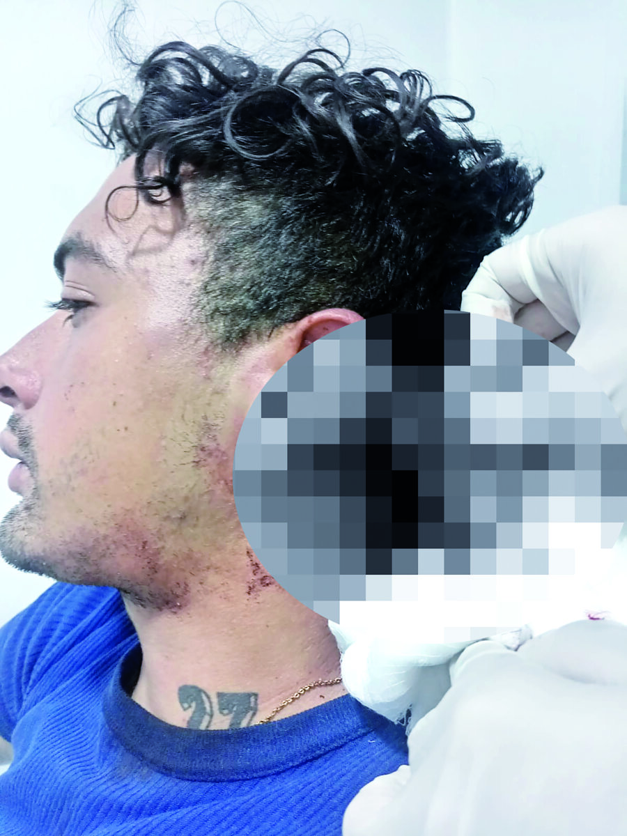 Brutal agresión en La Candelaria 3 Brutal agresión en La Candelaria José Daniel Sabogal, de 26 años, fue víctima de una brutal agresión en el barrio Belén, en La Candelaria.