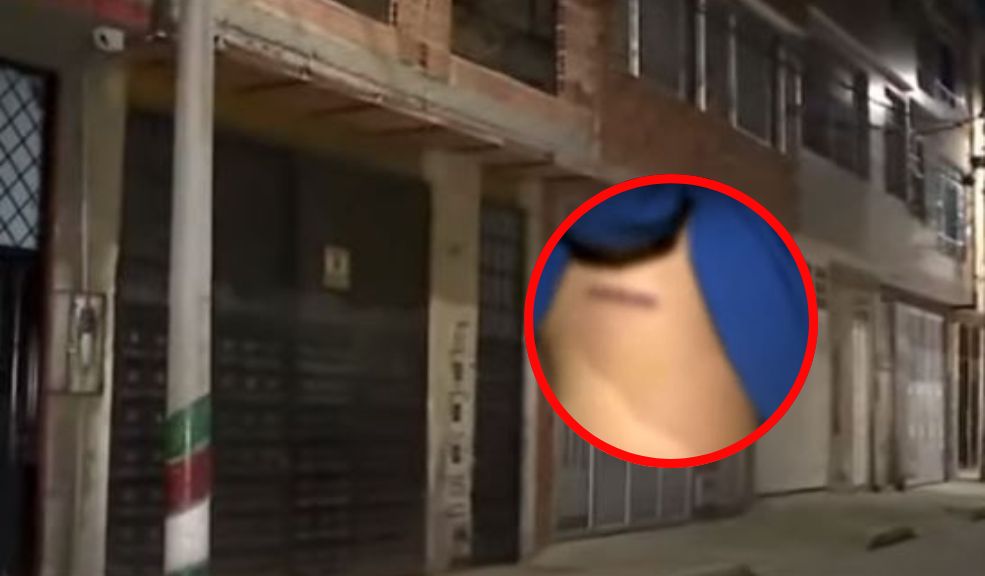 Joven terminó apuñalado por defender a su madre de 4 sujetos que querían robar su casa