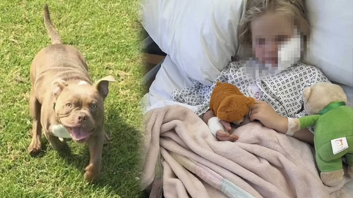 Terrible: Niña de 5 años acarició un perro y este le desfiguró la cara de un mordisco 7 Terrible: Niña de 5 años acarició un perro y este le desfiguró la cara de un mordisco La víctima, una niña de tan solo 5 años, experimentó un dramático cambio en su vida al intentar mostrar cariño a un canino. La menor, con la intención de acariciar al perro, sufrió graves heridas en su rostro luego de ser atacada por el animal.