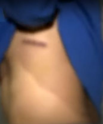 Joven terminó apuñalado por defender a su madre de 4 sujetos que querían robar su casa