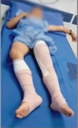 ¡Atroz! Un perro mordió 14 veces a un niño en Ciudad Bolívar 1 ¡Atroz! Un perro mordió 14 veces a un niño en Ciudad Bolívar En las últimas horas, se conoció la denuncia de una madre en el barrio Villas del Diamante de Ciudad Bolívar, pues su hijo de 10 años fue brutalmente atacado por un perro que lo mordió 14 veces, causándole graves heridas en todo su cuerpo.