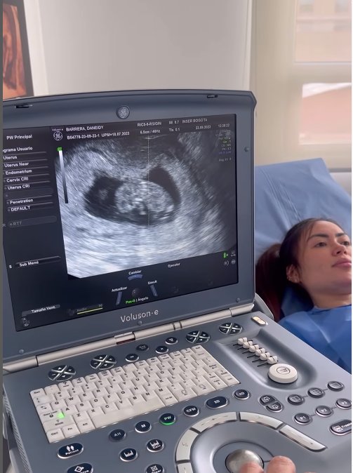 Epa Colombia confirmó su embarazo: será mamá de una niña 1 Epa Colombia confirmó su embarazo: será mamá de una niña Por medio de un vídeo en su perfil de Instagram, Daneidy Barrera, más conocida como 'Epa Colombia', confirmó que será mamá de una niña.