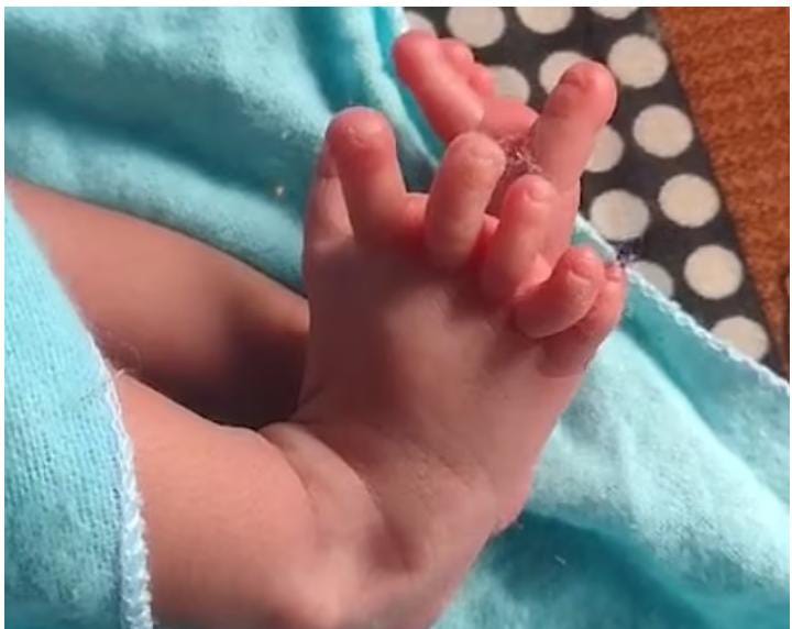 Niña con seis dedos es venerada como la reencarnación de una diosa 1 Niña con seis dedos es venerada como la reencarnación de una diosa Una niña nació con una condición genética sumamente inusual ha desencadenado un revuelo sin precedentes. La recién nacida tiene siete dedos en cada una de sus manos y seis en cada uno de sus pies, lo que suma un asombroso total de 26 dedos.