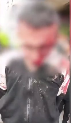 Comunidad le dio una dosis de 'paloterapia' a ladrón de carros en Ciudad Bolívar 2 Comunidad le dio una dosis de 'paloterapia' a ladrón de carros en Ciudad Bolívar Es común escuchar el dicho "la ocasión hace el ladrón" para justificar un hurto, y está impregnado en la cultura bogotana que "el vivo vive de bobo", por lo que algunas personas no dudan en aprovechar la oportunidad para robar, eso fue lo que ocurrió recientemente en la localidad de Ciudad Bolívar, donde un hombre intentó llevarse un carro y terminó recibiendo una golpiza por parte de la comunidad.