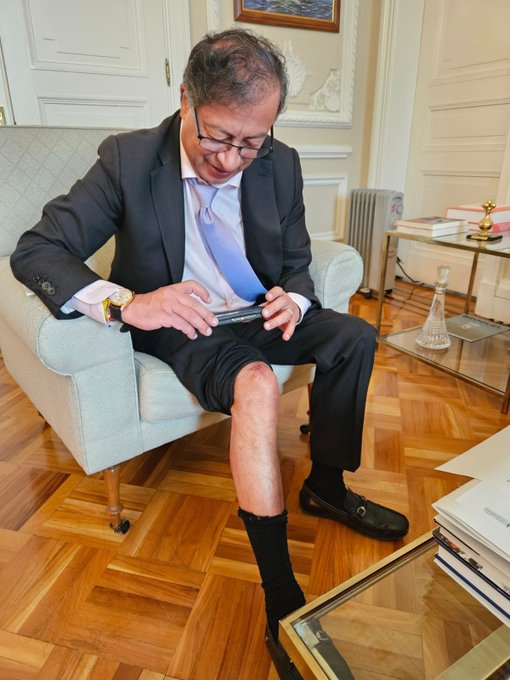 El 'Reto de la rodilla' impulsado por Petro La foto de la rodilla del presidente Gustavo Petro impulsó un nuevo reto en X.