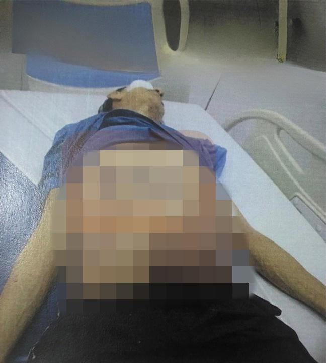 Filtran estremecedoras fotos del cuerpo de Garavito 3 Filtran estremecedoras fotos del cuerpo de Garavito Revelan las fotografías que comprueban la muerte de Luis Alfredo Garavito. Así lucía el mayor asesino y violador de niños antes de morir.