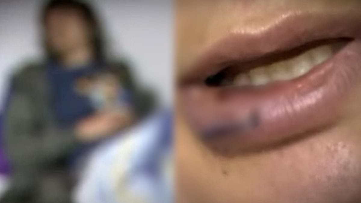 Mujer fue brutalmente golpeada por su orientación sexual en Chapinero 4 Mujer fue brutalmente golpeada por su orientación sexual en Chapinero En las últimas horas, se conoció un brutal ataque que sufrió una mujer dentro de un bar ubicado en la localidad de Chapinero, en hechos ocurridos este domingo, según lo que cuenta la víctima, fue golpeada por un hombre debido su orientación sexual, lo más grave del caso es que no es la primera vez que este sujeto la agrede.