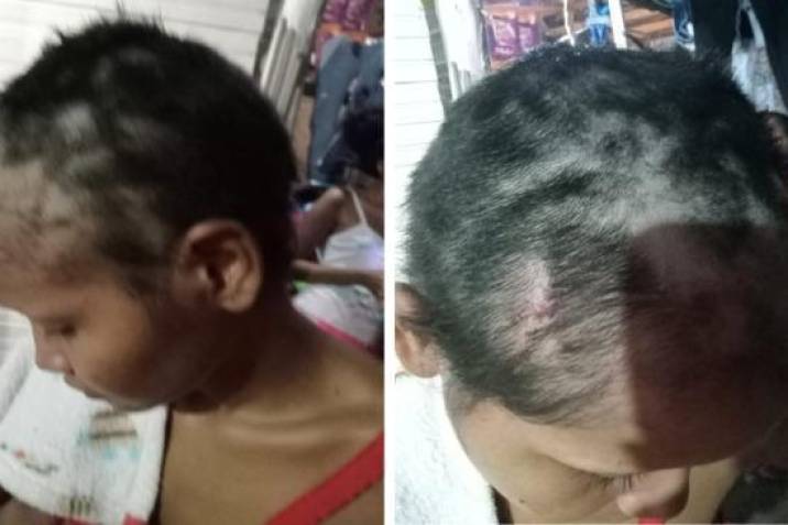 Mujer fue brutalmente agredida por su pareja: le rapó la cabeza y le afeitó las cejas 1 Mujer fue brutalmente agredida por su pareja: le rapó la cabeza y le afeitó las cejas Andrea Carolina Jiménez Arrieta denunció que fue víctima de agresiones por parte de su compañero sentimental, José Gregorio Oquendo Pérez.