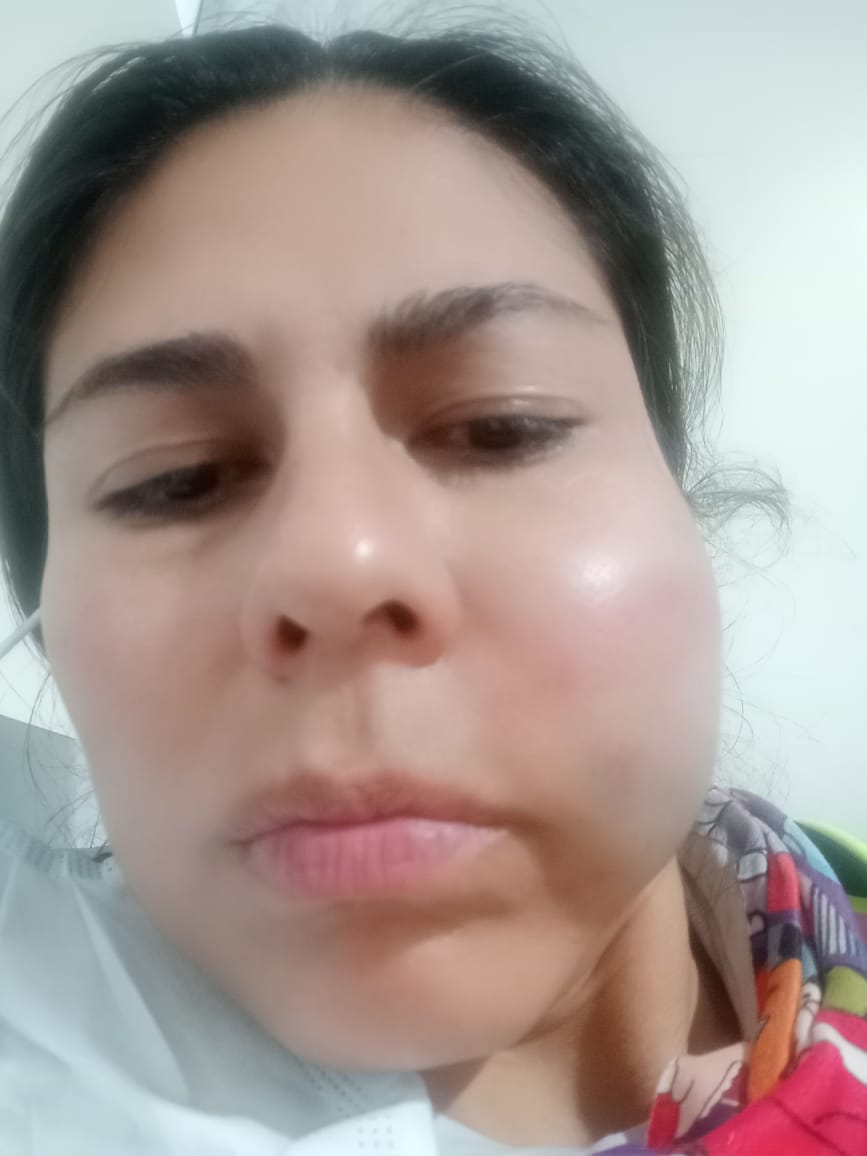 Víctimas de robo y golpiza en Normandía cuentan nuevos detalles sobre el crimen 2 Víctimas de robo y golpiza en Normandía cuentan nuevos detalles sobre el crimen Una mujer y su esposo fueron víctimas de tres delincuentes que de manera infame los golpearon por robarles sus bicicletas en el barrio Normandía, en la localidad de Engativá, cuando iban rumbo a su casa. Q'HUBO habló con las víctimas sobre el angustiante momento.