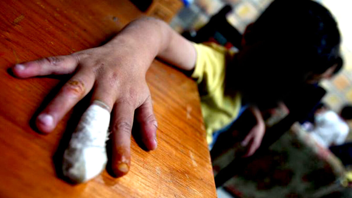 Menor lesionado con pólvora en Soacha En el municipio de Soacha en el barrio Primavera, un menor resultó lesionado tras manipular un pito pirotécnico en la noche de este sábado.
