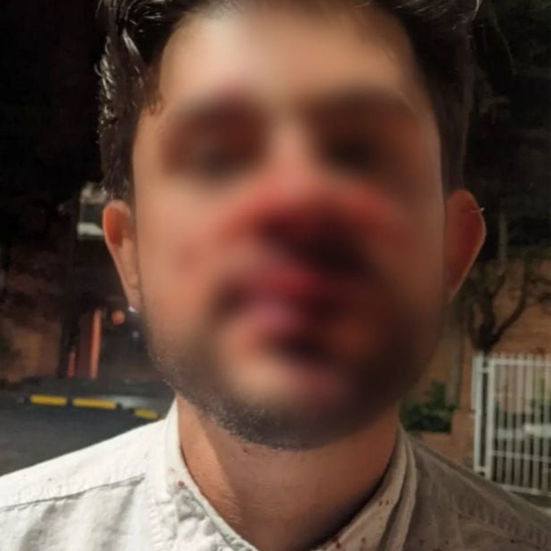 Hombre denuncia que conductor de plataforma lo golpeó por comer empanada en su carro Ignacio Mayorga denunció por medio de sus redes sociales, que en la noche del pasado 14 de diciembre un conductor de una plataforma de transporte lo golpeó brutalmente por comerse una empanada en su carro.