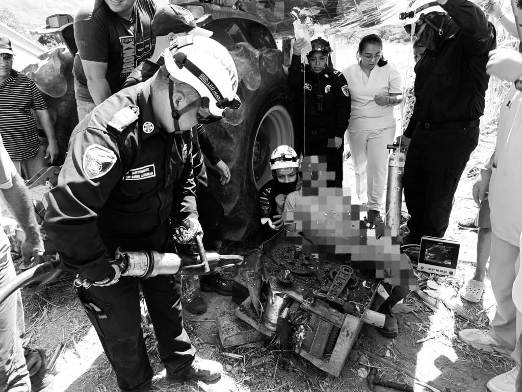 Operario perdió una pierna tras quedar atrapado en máquina picadora de maíz 1 Operario perdió una pierna tras quedar atrapado en máquina picadora de maíz El cuerpo de Bomberos de Cundinamarca informó del rescate de un hombre que sufrió un grave accidente con una máquina picadora de maíz, en la que su pierna derecha quedó atrapada. Los hechos se registraron la mañana de este lunes festivo en el municipio de Tocaima (Cundinamarca).