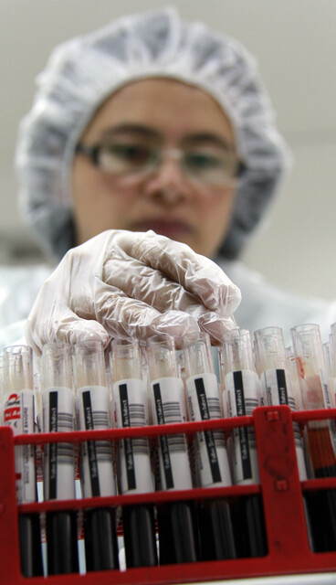 Lo que debe saber del mieloma múltiple El mieloma múltiple, un tipo de cáncer poco común, pero devastador, ha pasado desapercibido en muchos casos debido a que tiene síntomas similares a dolores de espalda comunes.
