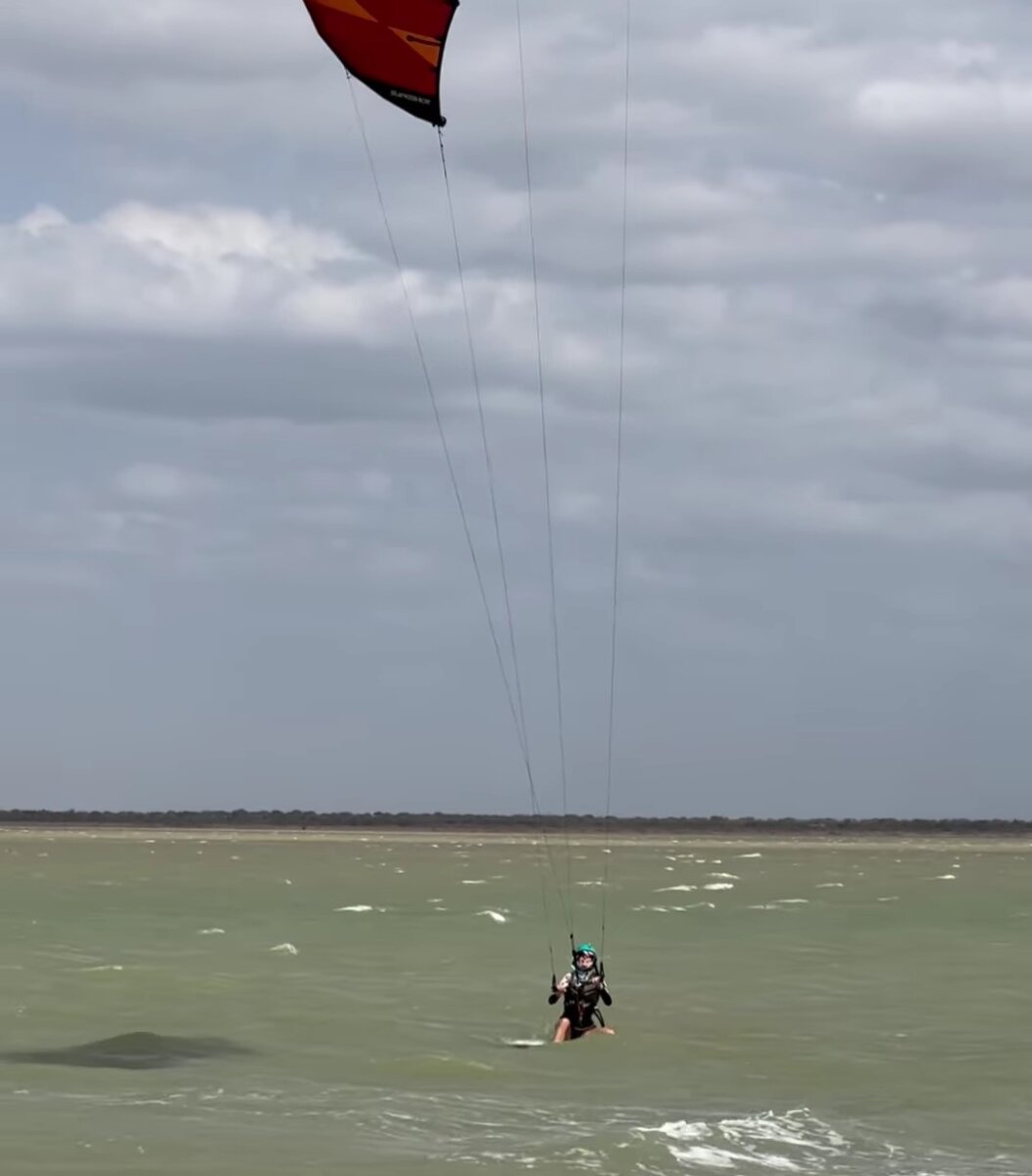 Claudia Bahamón sufrió grave accidente practicando deporte extremo Claudia Bahamón preocupó a sus seguidores al contar que había sufrido un accidente en el que se lastimó una cadera y terminó con una lesión en un pie.