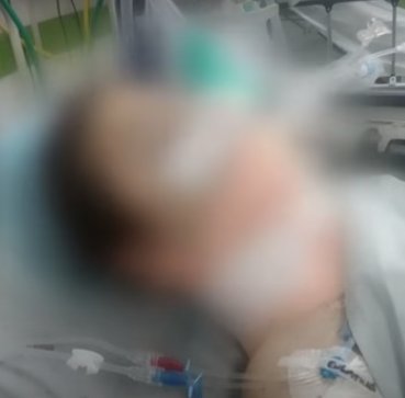 Taxista arrolló a joven ciclista y la dejó abandonada 2 Taxista arrolló a joven ciclista y la dejó abandonada La joven de 17 años se está debatiendo entre la vida y la muerte.