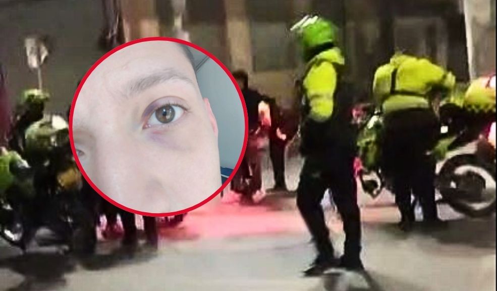 Denuncian presunta agresión policial a un joven en Kennedy 5 Denuncian presunta agresión policial a un joven en Kennedy Brayan Mauricio Fierro, de 22 años, un joven trabajador y habitante de la localidad de Kennedy, nunca se imaginó que luego de compartir tranquilamente unas cervezas con dos de sus amigos, fuera a ser víctima de un presunto abuso policial.