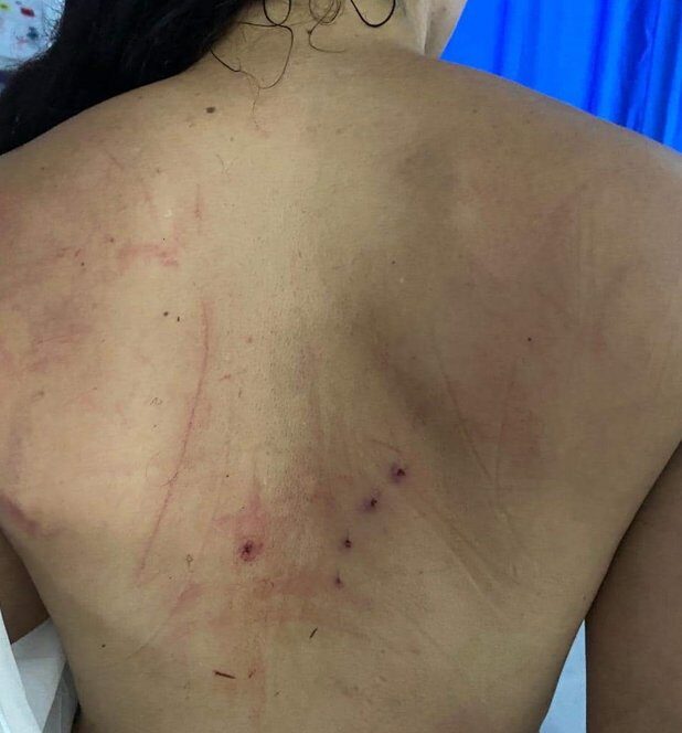 Estremecedor relato de intento de feminicidio 1 Estremecedor relato de intento de feminicidio Un estremecedor caso de intento de feminicidio se registró durante el fin de semana en Villeta (Cundinamarca). La víctima, quien se encuentra en un centro médico de la capital, le relató a Q’HUBO la pesadilla que vivió por cuenta de un desconocido que la abordó cuando estaba haciendo deporte.
