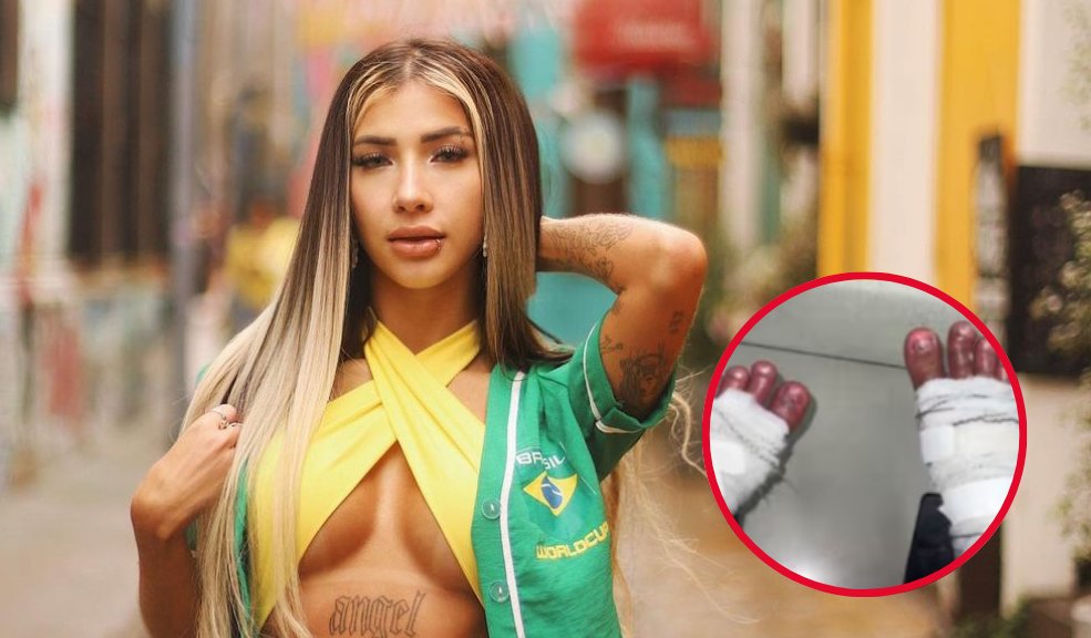 Influencer está al borde de perder los pies por peligroso reto viral Tras completar el reto, Thammy Caroline estuvo al borde de perder ambos pies, enfrentando quemaduras de primer grado en el exterior y de segundo grado en el interior.