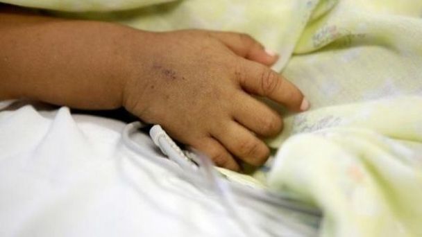 Capturan a hombre que asesinó a puñal a su hijastro de un año El hombre hirió a su pareja sentimental y mató al bebé.