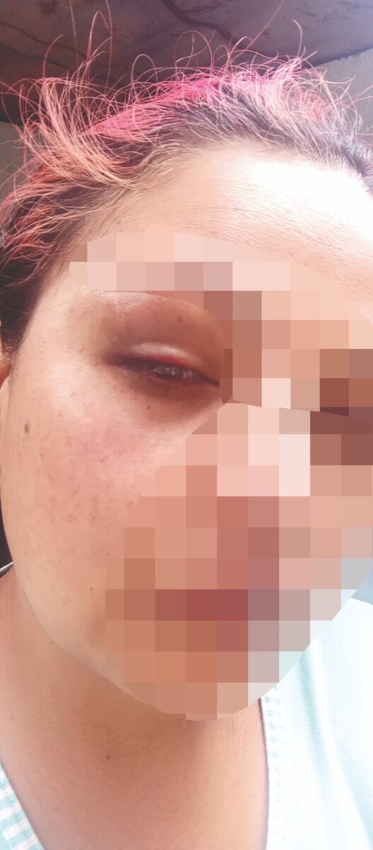 Detalles de riña que dejó a una madre y una menor con heridas de bala en Ciudad Bolívar En medio de una riña en la invasión El Ensueño II, en Ciudad Bolívar, varias personas resultaron lesionadas, entre ellas una menor de 13 años que recibió un impacto por arma de fuego.