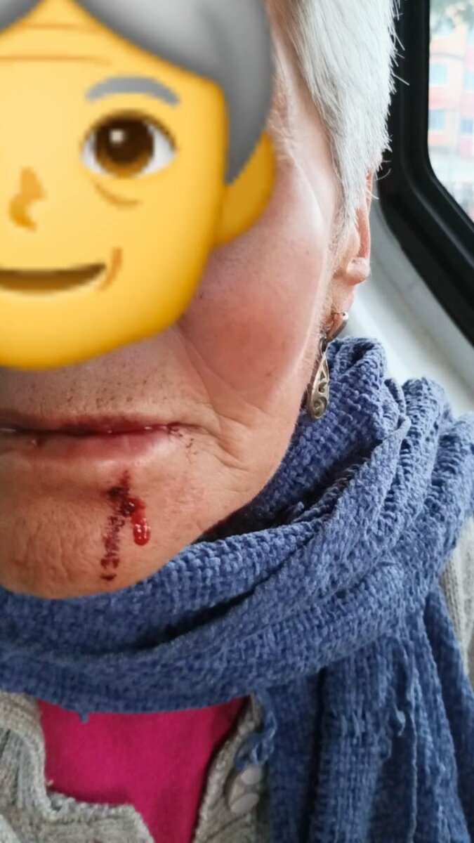 Hombre golpeó brutalmente a una abuelita mientras caminaba en Bogotá 1 Hombre golpeó brutalmente a una abuelita mientras caminaba en Bogotá En video quedó registrado el momento en el que un hombre agrede a una abuelita de 80 años en una calle de Bogotá.