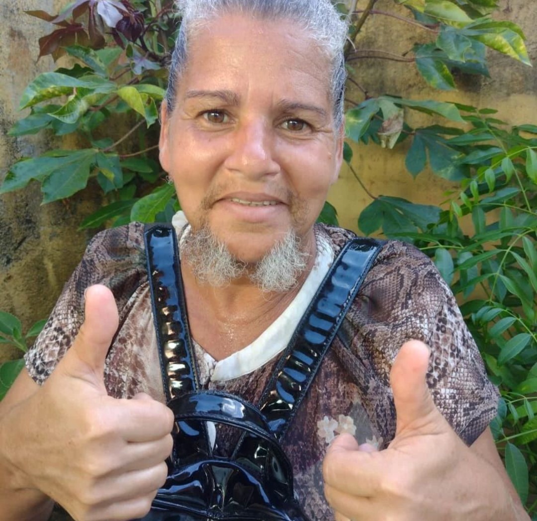 Mujer se dejó crecer la barba y casi le cuesta su matrimonio Conozca a la mujer que aceptó su condición física y se siente completa después de dejarse crecer la barba. Su acto de amor propio casi acaba con su matrimonio.