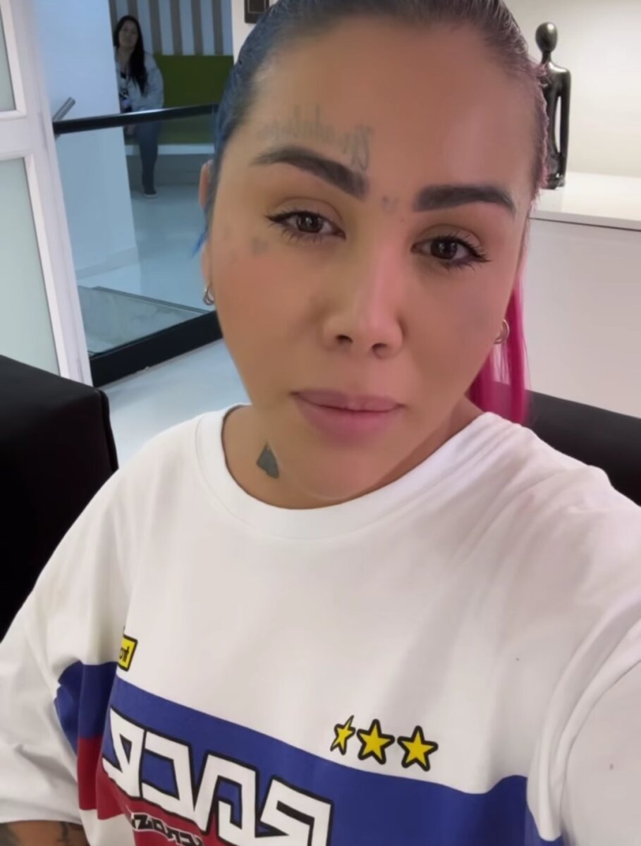 Yina Calderón se sometió a doloroso procedimiento para retirar líquidos de sus glúteos 1 Yina Calderón se sometió a doloroso procedimiento para retirar líquidos de sus glúteos La DJ de guaracha no pudo contener el llanto en medio de la extracción.