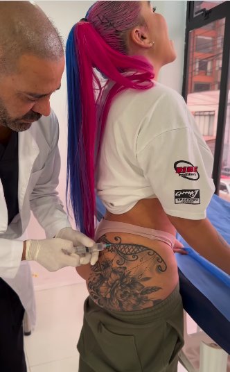 Yina Calderón se sometió a doloroso procedimiento para retirar líquidos de sus glúteos 2 Yina Calderón se sometió a doloroso procedimiento para retirar líquidos de sus glúteos La DJ de guaracha no pudo contener el llanto en medio de la extracción.
