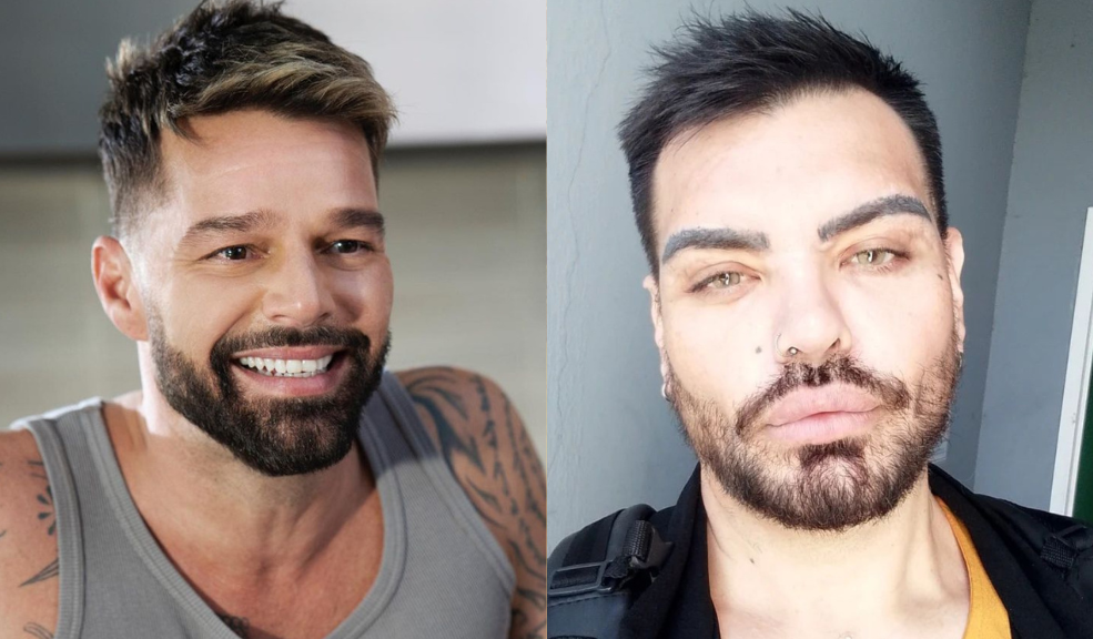 ¿Se parece? Hombre se sometió a más de 30 cirugías estéticas para verse como Ricky Martin Entre los procedimientos a los que se ha sometido se encuentran modificaciones en los pómulos, lifting en el cuello, liposucción de papada, intervenciones en el mentón, aumento de glúteos, entre otros.