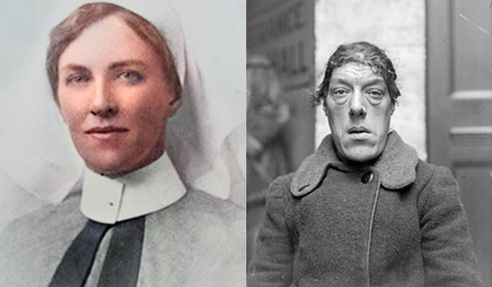La mujer que aguantó ser la más fea del mundo por sus hijos La historia de Mary Ann Bevan se convirtió en un símbolo de sacrificio maternal ante la adversidad.