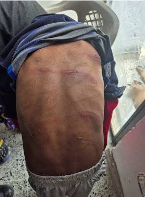 Capturan a padrastro que golpeaba brutalmente a 3 niños en Soacha El hombre presuntamente agredía a los menores cada vez que discutía con su pareja sentimental. Los hechos ocurrieron en el municipio de Soacha.