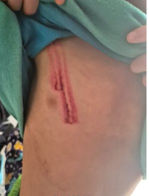 Capturan a padrastro que golpeaba brutalmente a 3 niños en Soacha El hombre presuntamente agredía a los menores cada vez que discutía con su pareja sentimental. Los hechos ocurrieron en el municipio de Soacha.