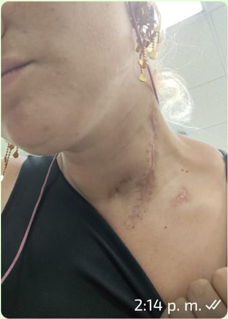 Lina estuvo al borde de la muerte por brutal ataque de su inquilino Lina sobrevivió al salvaje ataque de un inquilino que se obsesionó con ella. Lo insólito del hecho es que el hombre está libre, por lo que la víctima pide justicia.