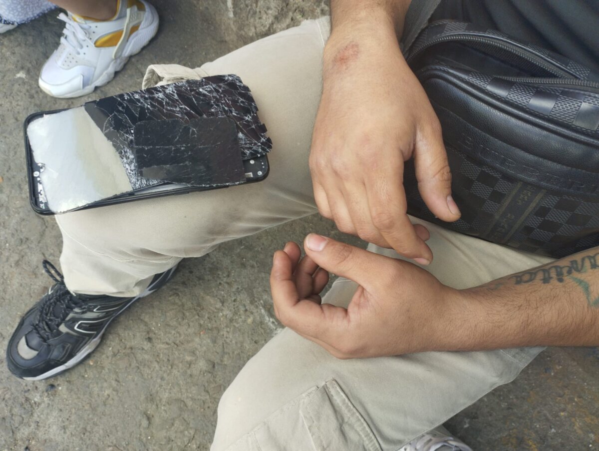 Carlos fue arrollado por un Sitp en El Restrepo, ahora vive una pesadilla 1 Carlos fue arrollado por un Sitp en El Restrepo, ahora vive una pesadilla El conductor del Sitp alega que no vio a Carlos; sin embargo, él lo desmintió.
