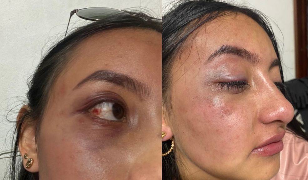 "Me quería matar": joven denuncia agresiones y amenazas por parte de su exnovio La joven Angie Bastidas denunció que su expareja la ha maltratado y amenazado durante cuatro años. A pesar de buscar ayuda, asegura que las autoridades no le han brindado el apoyo necesario.