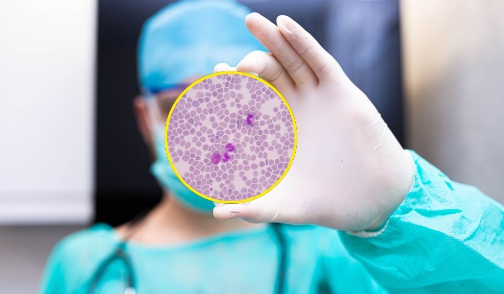 La sepsis, una enfermedad que cobra 11 millones de vidas al año 4 La sepsis, una enfermedad que cobra 11 millones de vidas al año A nivel global, la OMS destaca que el 20% de las muertes registradas en el mundo están relacionadas con la sepsis. Con una detección temprana y un tratamiento adecuado, muchos de estos casos podrían prevenirse.